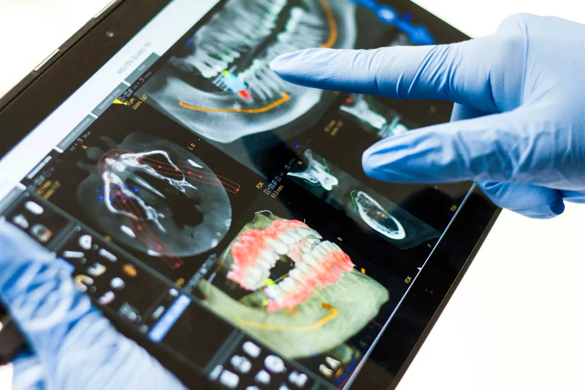 Digitales Volumentomographie-Gerät (DVT) in der Praxis